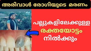 68.അരിവാൾരോഗമുള്ളവരിൽ വായ കാണിച്ചുതരുന്ന ലക്ഷണങ്ങൾ !! 😳🌙