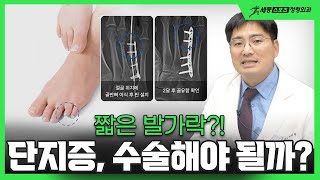 짧은 발가락, 수술해야 할까요? 단지증