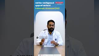 വയറിലെ സങ്കീർണ്ണതകൾ കൃത്യമായി അറിയാൻ Endoscopic Ultrasound (EUS) | Dr. Anup S Nair