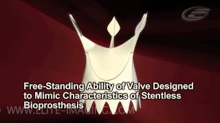 Heart Valve Manufacturing Process - Medical & Scientific Video Production