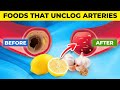 10 AMAZING Foods that UNCLOG Arteries...