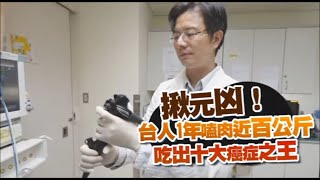 大腸癌 | 台灣十大癌症之王解密！大腸癌多可怕一次完全搞清楚 | 台灣新聞 Taiwan 蘋果新聞網