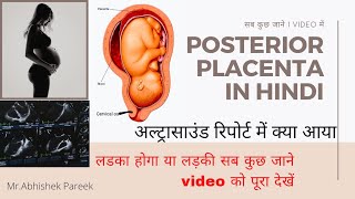 Posterior Placenta in hindi // Placenta position // placenta Grade// posterior Placenta क्या होता है