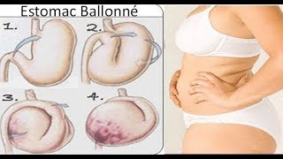 3 mauvaises habitudes qui provoquent des ballonnements