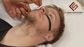 Demonstration of the SphenoCath Intranasal Catheter Procedure  (888) 568-6909