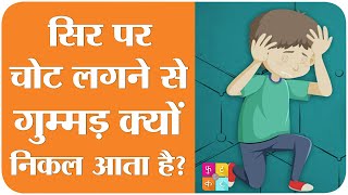 सिर पर Injury के बाद Bump हो जाता है तो तुरंत ये चीज़ करें |Tan Ki Baat|Sehat ep 144