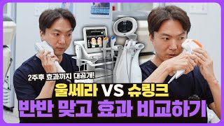 울쎄라 VS 슈링크 셀프 시술, 효과 차이 비교해봤습니다❗️ I 통증, 가격, 시술주기 I