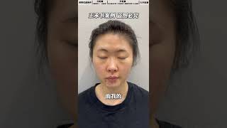 教你get“菲式”骨相美感，变美的正确思路 #beauty #antiagingsecrets #injectiontechniques #medicalprocedure #伊妍仕 #刘亦菲