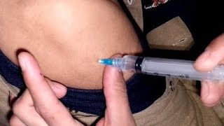 IM Intramuscular injection | Injection Vlog new Hospital Vlog 2025 | Painful Experience!