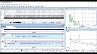 Visi-Pitch, Model 3950c: Analysis of Dysphonia in Speech and Voice (ADSV) Tutorial