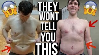 Zach's RAW Loose Skin Surgery Story (230 Pound Weight Loss)