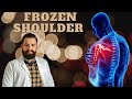 Treating Frozen Shoulder with a combination of Master Tung Acupuncture, YNSA and bleeding techniques