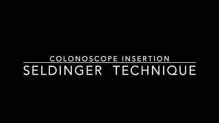 Colonoscopy - Insertion - Seldinger Technique