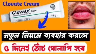 Clovate Cream For Lips ৫ দিনেই ঠোঁট গোলাপি হবে 😱 ঠোঁট গোলাপি করার ক্রিম। How To Get Pink Lips