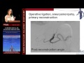 Management of Visceral Artery Aneurysms (Tam Huynh, MD)