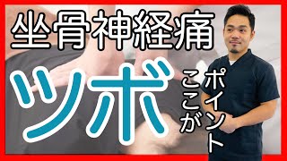 【坐骨神経痛　ツボ】坐骨神経痛のツボはここ！　名古屋市東区えい整骨院