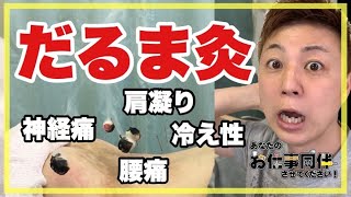 腰痛・肩こり・冷え性・神経痛でお困りの方！これが鍼灸の秘技！灸頭鍼の進化版『だるま灸』だ！【第４回 あなたのお仕事同伴させてください！】