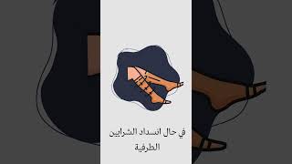 متى لا يجب علينا إرتداء الجوارب الطبية ؟