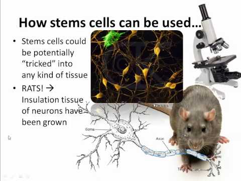 Stem cells (IB Biology)