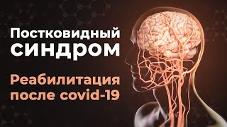 Что такое постковидный синдром? Симптомы и реабилитация после COVID-19.