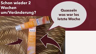 Produkttest/Balea Dunkle Flecken Aufheller/so schnell sind 2 Wochen um