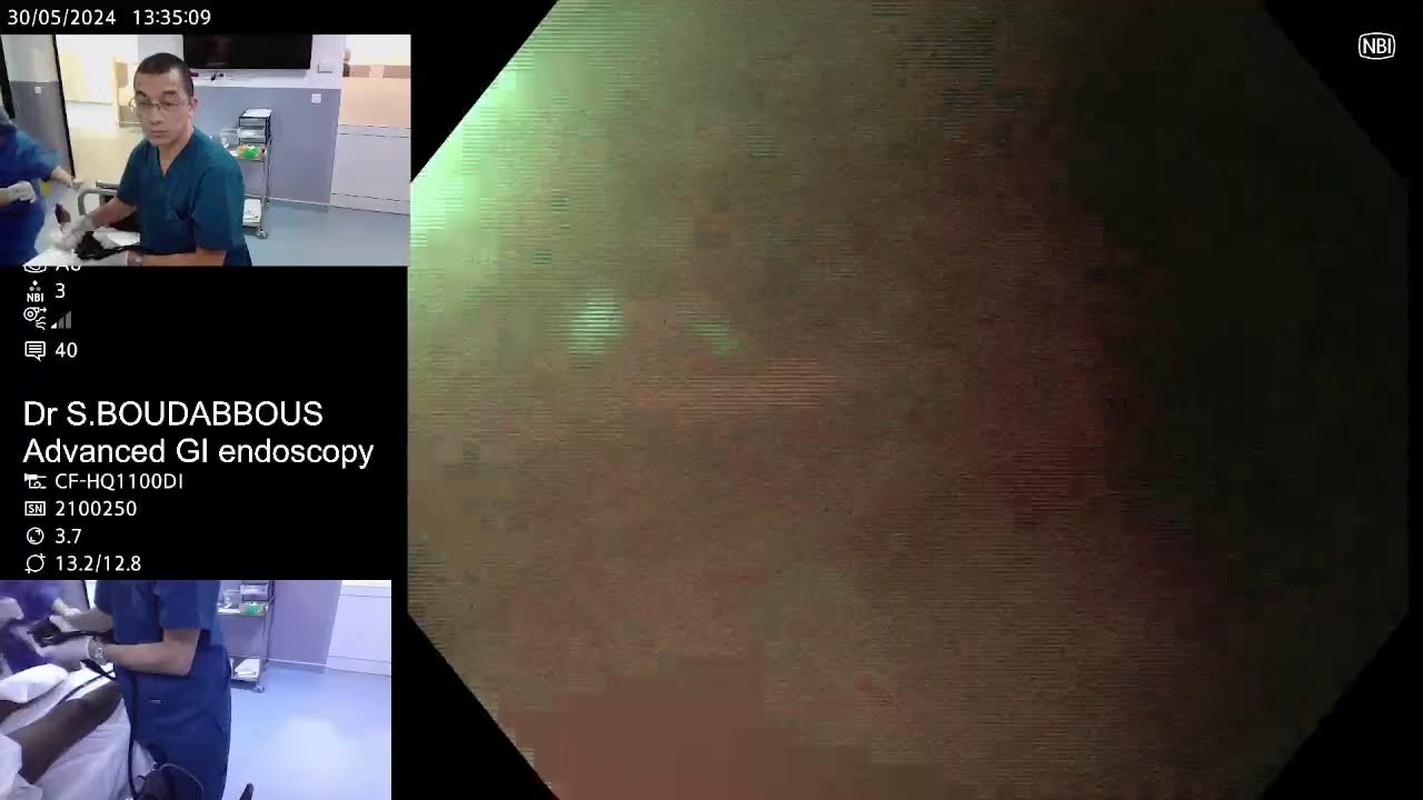 Screening Endoscopy Youtube