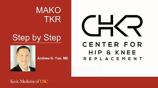 MAKO Total Knee Replacement (Step by Step)