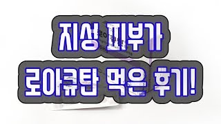 지성피부가 여드름약! 로아큐탄 먹어본 후기!