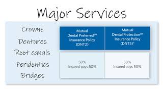 Mutual of Omaha Product Walkthrough: Dental