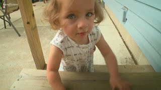 MN toddler among handful of babies to survive In Utero tumor removal