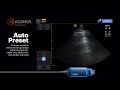 Kosmos on iOS Full POCUS Capabilities