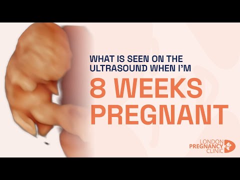 Can a baby move at 8 weeks?