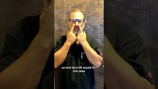 What Is A Mid Facelift?