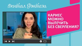 А вы знали, что кариес можно вылечить без сверления❓🦷