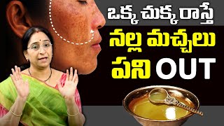 Ramaa Raavi - Skin Care Tips - Simple Home Remedies Dor Black Spots, Acne and Pimples from Face