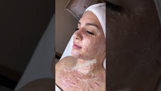 SKINCARE PEELING OMG #video #viral #skincare #asmr #makeup #shortvideo #shorts #shortvideo #peeling