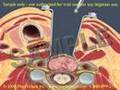 Anterior Cervical Fusion: 3D/2D Medical Animation