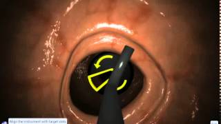 EndoSim Fundamental Endoscopy Skills 1: Scope Handling