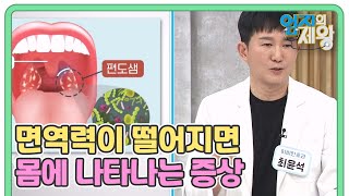 이게 면역력 때문? 면역력이 떨어지면 내 몸에 나타나는 증상 MBN 230307 방송