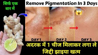 अदरक से झाइयां हटाने का कमाल का तरीका | Reduce Melasma, Pigmentation, Discolouration, Blackspots