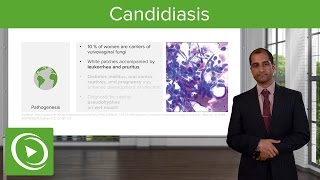 Candididal Infections – Sexually Transmitted Diseases (STDs) | Lecturio