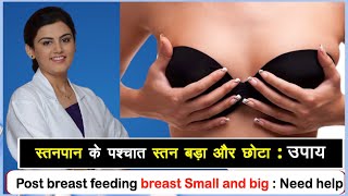 Breasts Small and big: post breastfeeding |स्तनपान के पश्चात स्तन बड़ा और छोटा: उपाय | Dr Puja Dewan