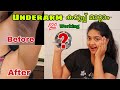 How to Lighten Dark underarms malayalam _ കറുപ്പ് മാറ്റാം എളുപ്പത്തിൽ  😳 #notsponsored