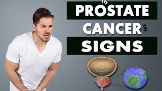 Prostate Cancer - Signs and Symptoms of Prostate Cancer