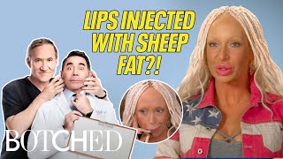 Ashley Has SHEEP FAT Injected In Her Lips?! (Before & After) | Botched | E!