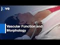 Vascular Function and Morphology by Non-invasive Asesment | Protocol Preview