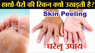 हाथों-पैरों की स्किन क्यों उखड़ती है? Skin Peeling | Apras ka ilaj