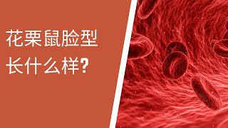 北美儿科/Thalassemia/地中海贫血