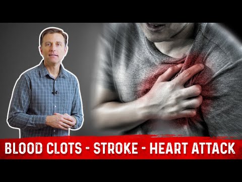 How to Avoid Blood Clots, a Stroke & Heart Attacks How to Avoid Blood Clots, a Stroke & Heart Attacks