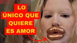 ¡LA MUJER CON LOS LABIOS MÁS GRANDES DEL MUNDO! | Mundo Insólito | EVTV | 07/10/2023 2/3